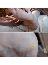 爪切り屋 足楽/