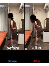 半蔵門駅前整体院/30代女性事例【腰痛改善】