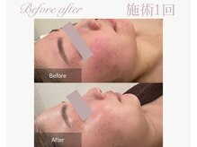 パルタージュ(Partage)/