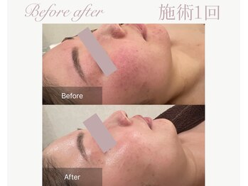 パルタージュ(Partage)/