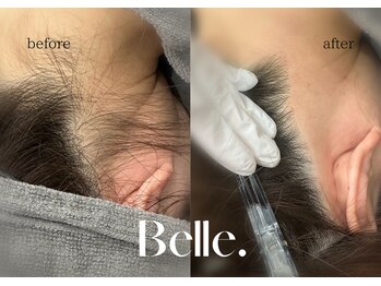 ベル(Belle)/【ワックス】瞬時にツルスベ肌に