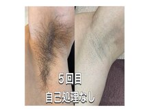 ルルアス(LuLu AS)