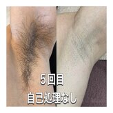 ルルアス(LuLu AS)