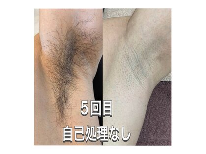 ルルアス(LuLu AS)の写真