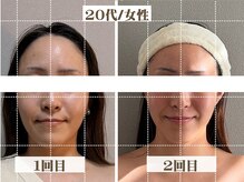 コガオラボ 甲府店(KOGAO LABO)/お客様☆Before&After☆