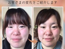 ファミリア(Familiar.)の雰囲気（小顔コルギは痛すぎない心地よいお力加減で。デコルテ＆ヘッド付）