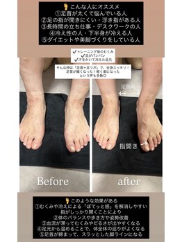 ローリエ/足湯足ツボで首肩こり軽減する。