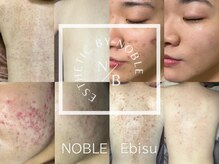 ノーブル 恵比寿店(NOBLE)