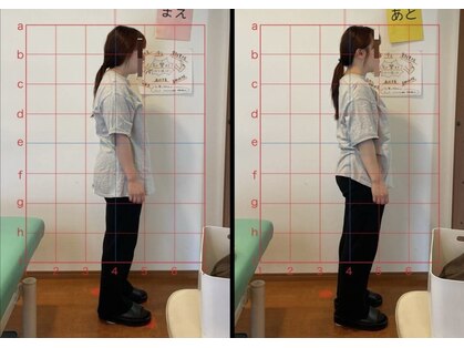 のため整骨院の写真