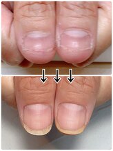 スマイルニコ(smile nico)/爪のピンクの部分が伸ばしたい