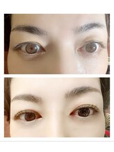 アルファ(alpha)/セラムラッシュリフト