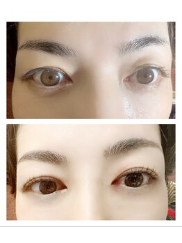 アルファ(alpha)/セラムラッシュリフト