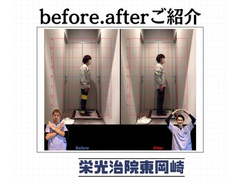 栄光治院 整体院東岡崎/猫背矯正で健康な身体へ