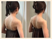 ラフリー 神戸三宮院(RUFFREE)/背中美人に大変化【神戸三宮】