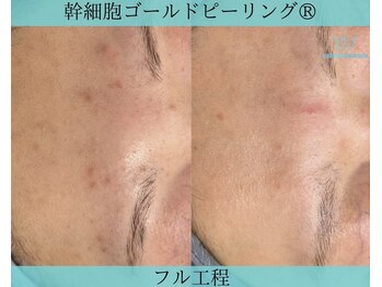 リメイククリニカルビューティー(Remake clinical beauty)/