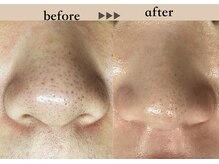 ソーヴ(SOLVE)/フェイスワックス/シェービング