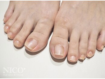 ニコプラス(NICO+)/フット爪育ネイルケア