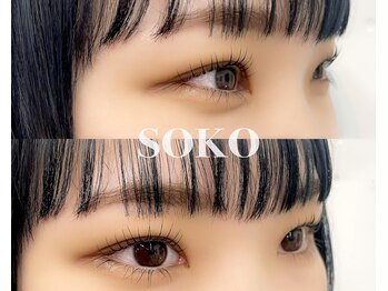 ソーコ(SOKO)