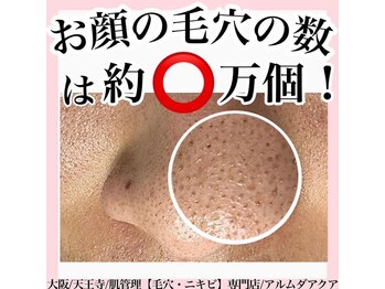 アルムダアクア 天王寺店(Aleumda AQUA)/毛穴エクストラクションプロ大阪
