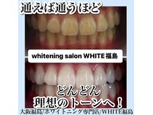 ホワイトニングサロン ホワイト(WHITE)/セルフホワイトニング/大阪/福島