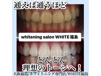 ホワイトニングサロン ホワイト(WHITE)/セルフホワイトニング/大阪/福島