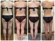 エステサロン 美飾り イオンモール木更津店/before⇒afteｒ/全身痩せ