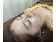 リアン(Re.庵)の雰囲気（姪浜で美容鍼ならRe.庵へ◎エステ×美容鍼が高評価◎満足度↑↑）