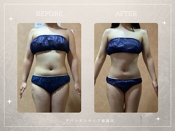 アバンダンティア 姫路店/脂肪冷却