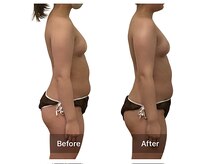 ベンザイ 新潟店(BENZAI)/痩身サロン？劇的サイズダウン