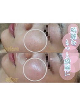 お肌をきれいにしたい