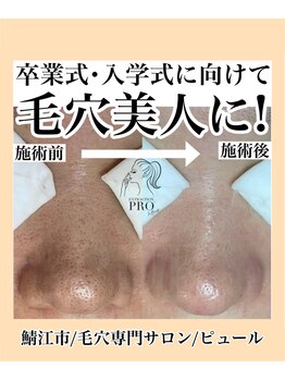 ピュール 鯖江店(PUR)/毛穴/毛穴ケア/毛穴洗浄