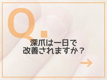 レアム/【Q.１】1日で改善するの？