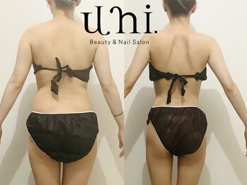 ユニ(uni.)の写真/【ドレス映え間違いなし！天使の羽爆誕】挙式やブライダルフォトを控えるあなたに！駆け込みの方も大歓迎◎