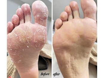 ラヴィ(La vie)/履くだけ角質ケア使ってみたら…