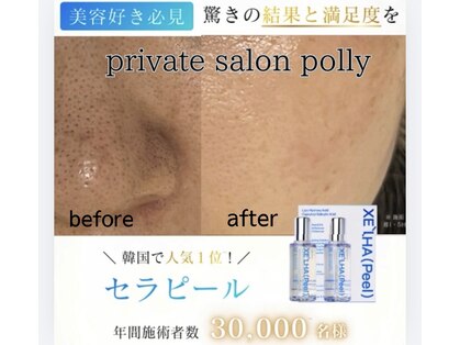 ポリー(Polly)の写真