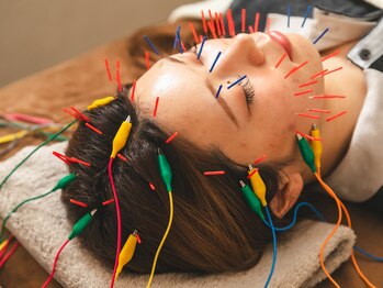 潤(URUOI)の写真/《電気鍼×整体》睡眠の質を高める／お顔のハリツヤを整える！上質な睡眠を手に入れて脳も身体もスッキリ◎
