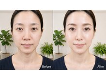 リーム(Re:im)の雰囲気（お顔の形を分析してその方にあった目元のキレイをご提案します♪）