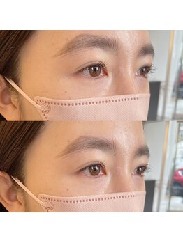 ビスチェ(VISCHE)/ラッシュリフト