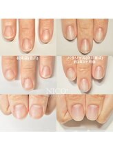 ニコプラス(NICO+)/自爪育成中