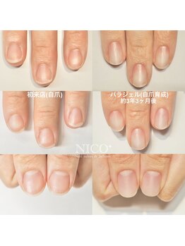 ニコプラス(NICO+)/自爪育成中