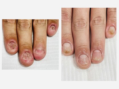 アネラ(Anela)の写真