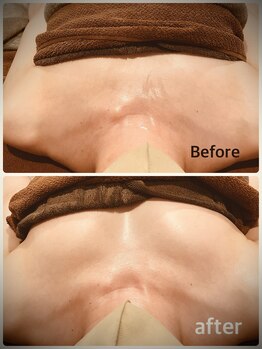 ビアス(Biasu)/【本気のバストUP】ぷるんバスト