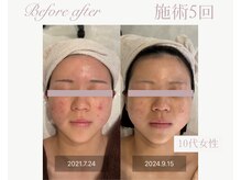 パルタージュ(Partage)/オーダーメイドエステ