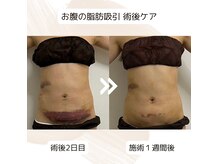 アピ(api)の雰囲気（術後ケアの得意なサロン。少ないインディバ回数でも効果を実感。）