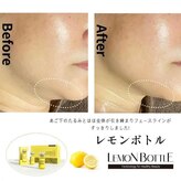 ビボウ(Bibou)