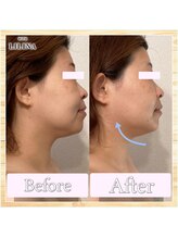 ウィズリリナ 新横浜(with Lilina.)/小顔頭蓋骨矯正/1回/新横浜