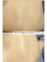 ムム(mumu)/背中もツルツル艶々