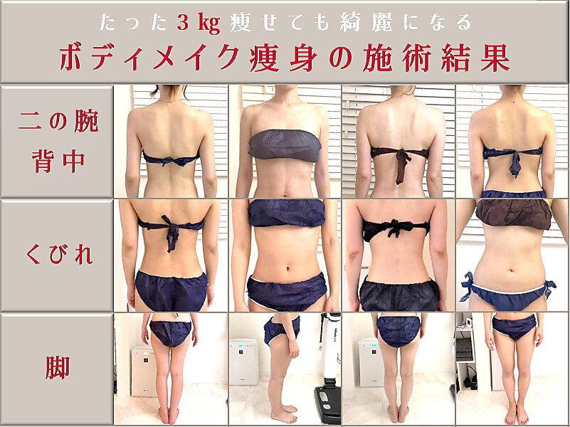 墨田区で痩身が人気のエステサロン｜ホットペッパービューティー