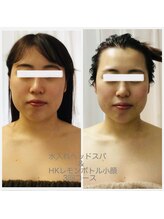 ラヴィソンファム(Ravissant femme)/小顔/脂肪/レモンボトル