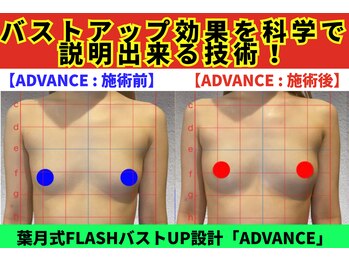 セブンシーズ 上野店(Seven Seas)/バストアップ/豊胸/東京都/上野